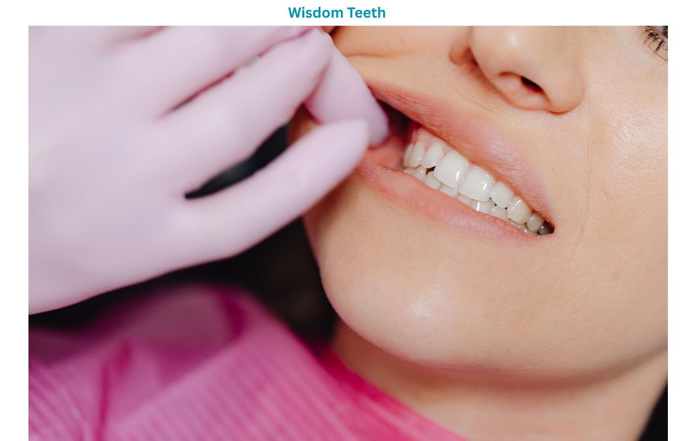 Impacted Wisdom Teeth Causes, Symptoms, and Treatment Options